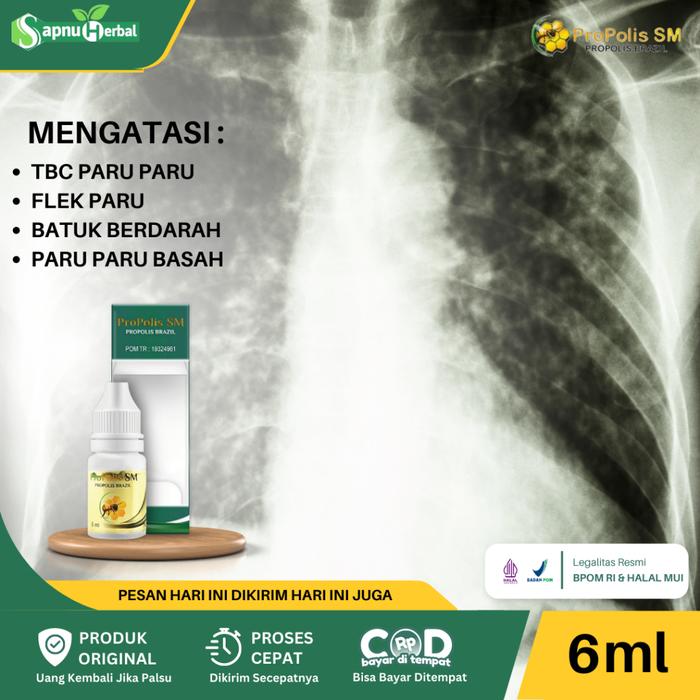 OBAT TBC PARU, ASMA, PEMBERSIH PARU PARU, INFEKSI PARU PARU, RADANG PARU PARU, SESAK NAFAS, BATUK BE