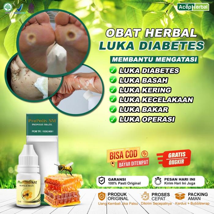 OBAT LUKA DIABETES OBAT PENGERING LUKA DIABETES OBAT LUKA DIABETES KERING OBAT LUKA DIABETES BASAH O
