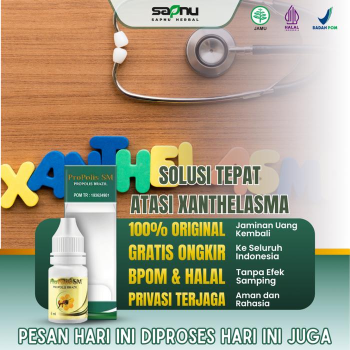 OBAT XANTHELASMA, OBAT PENGHILANG LEMAK DI KELOPAK MATA, OBAT PENGHILANG PLAK MATA KUNING DI KELOPAK