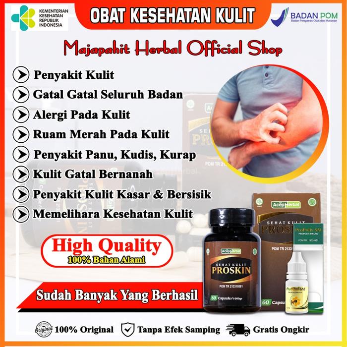 OBAT GATAL SELURUH BADAN EKSIM MENAHUN HERPES KURAP KUDIS PANU BUDUG HAPUR PROPOLIS SM DAN PROSKIN