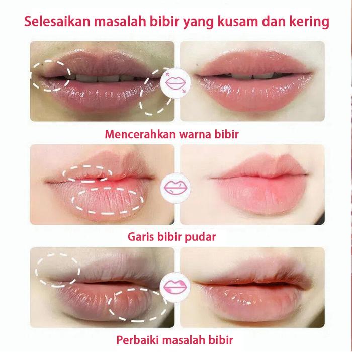 Obat kutil penghilang kutil dan tahi lalat penghilang tahi lalat 20g