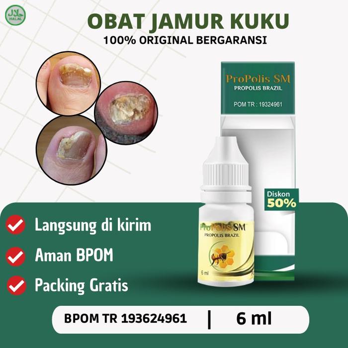 PROPOLIS SM - OBAT KUKU JAMUR DAN RUSAK, OBAT JAMUR KUKU, OBAT KUKU RUSAK, OBAT JAMUR KUKU KAKI DAN
