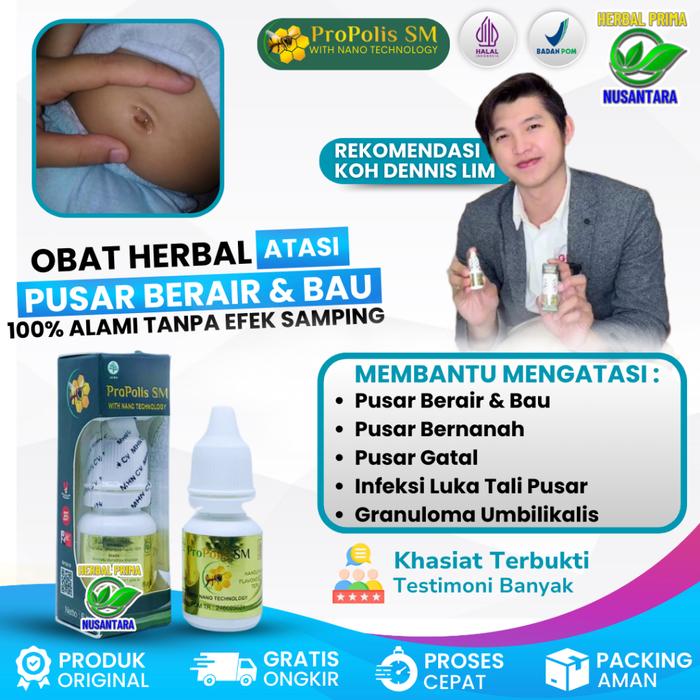 OBAT TETES OLES PUSAR BERAIR, PUSAR BERAIR DAN BAU, PUSAR GATAL, PUSAR BENGKAK, INFEKSI TALI PUSAR B