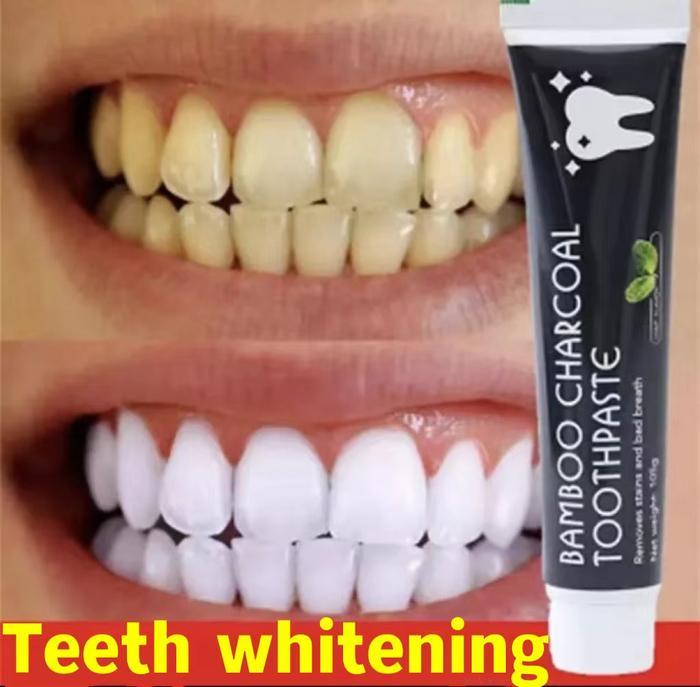 Spray Teeth Whitening Spray Pemutih Gigi Dan Penghilang Karang Gigi