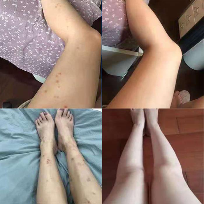 【HOT】Sabun pemutih badan Lotion pemutih badan Sabun mandi pemutih