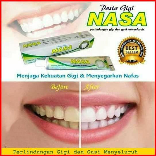 ANTI KARAT ALAT KIKIR KARANG GIGI MANUAL 1 SISI | PEMBERSIH PENGHILANG