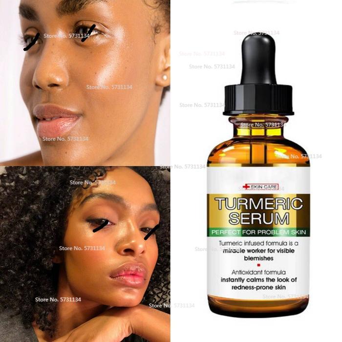 Tumeric Lemon Oil, Skin Glow, Dark Patches, Acne, Bright Skin