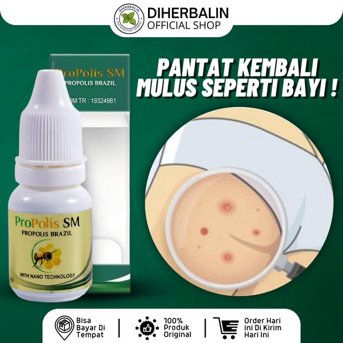 PROPOLIS SM - OBAT KORENG DI PANTAT, OBAT PANTAT BURIK, OBAT PANTAT GATAL, OBAT PANTAT BRUNTUSAN, OB