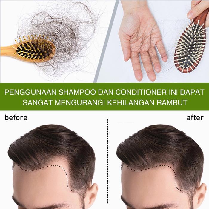 Obat penumbuh rambut Penumbuh rambut botak Serum penumbuh rambut Hair