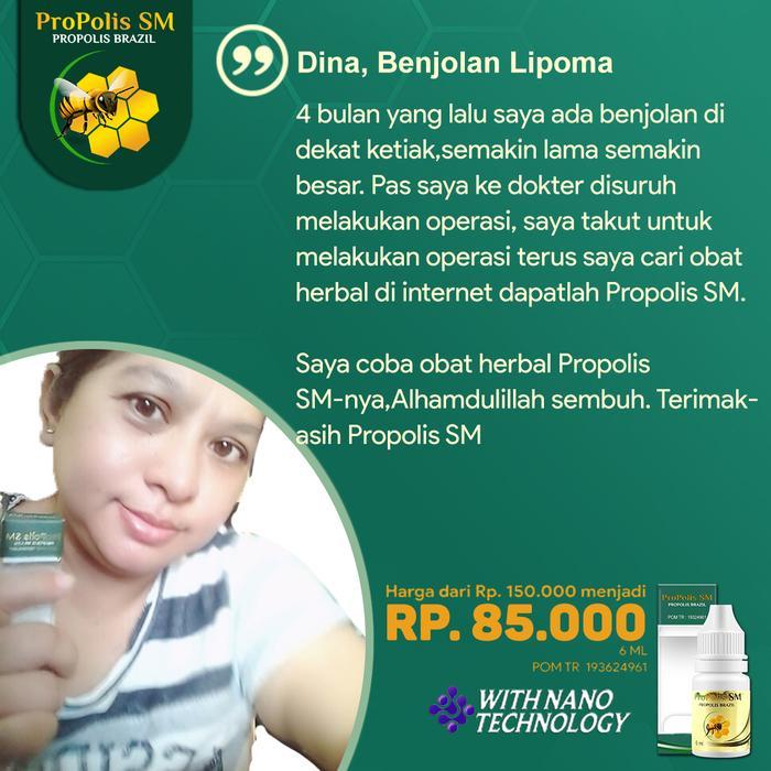 Alat Pembersih Karang Gigi YOUPIN Dental Calculus Remover Scaling