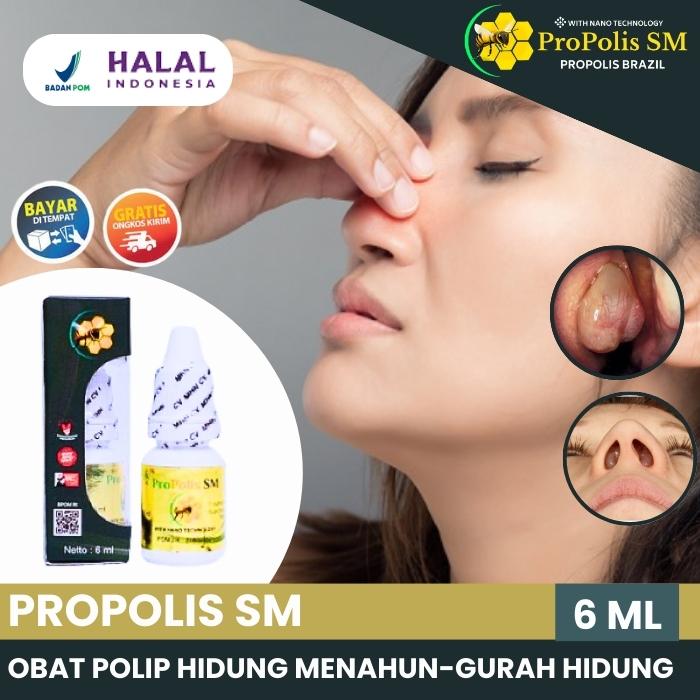 OBAT POLIP HIDUNG MENAHUN, GURAH INGUS BAU BUSUK, SERING MIMISAN, MELER PROPOLIS SM BRAZIL
