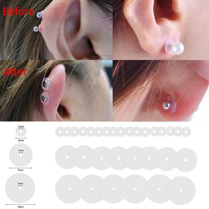 nopul anti keloid / nopul /nopull penyembuh keloid