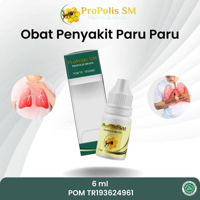 OBAT PARU PARU AKIBAT MEROKOK FLEK PARU PARU TBC PARU PARU BATUK BERDARAH PARU BASAH KANKER PARU PAR