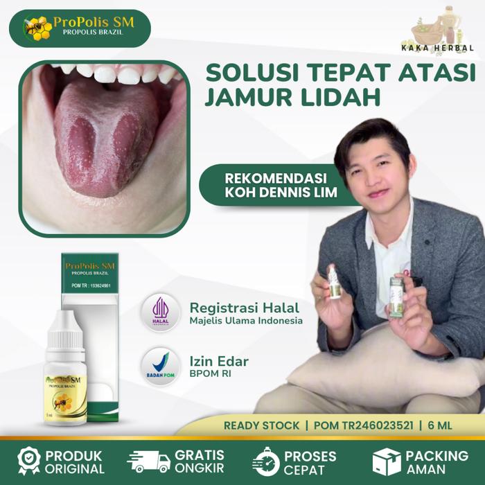 KAKA HERBAL - OBAT JAMUR LIDAH, OBAT KANDIDIASIS, OBAT LIDAH PUTIH BAYI, OBAT LIDAH MATI RASA, KEBAS
