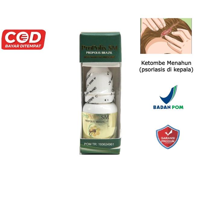 OBAT KETOMBE BERKERAK PSORIASIS KEPALA KETOMBE PARAH KETOMBE RAMBUT HERBAL UNTUK KETOMBE MENAHUN