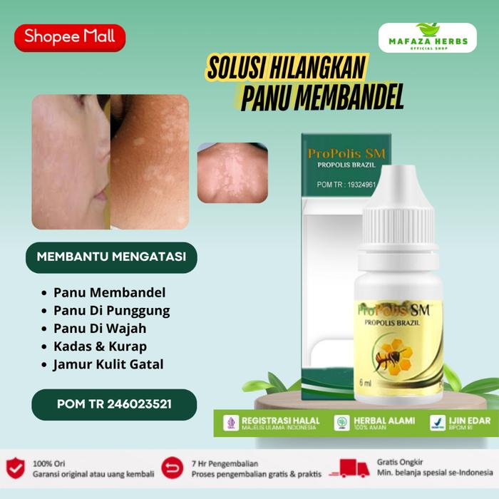 PROPOLIS SM OBAT PENGHILANG PANU DI WAJAH PUNGGUNG PANU KADAS KURAP KUDIS PANU DI SELURUH TUBUH 6ML