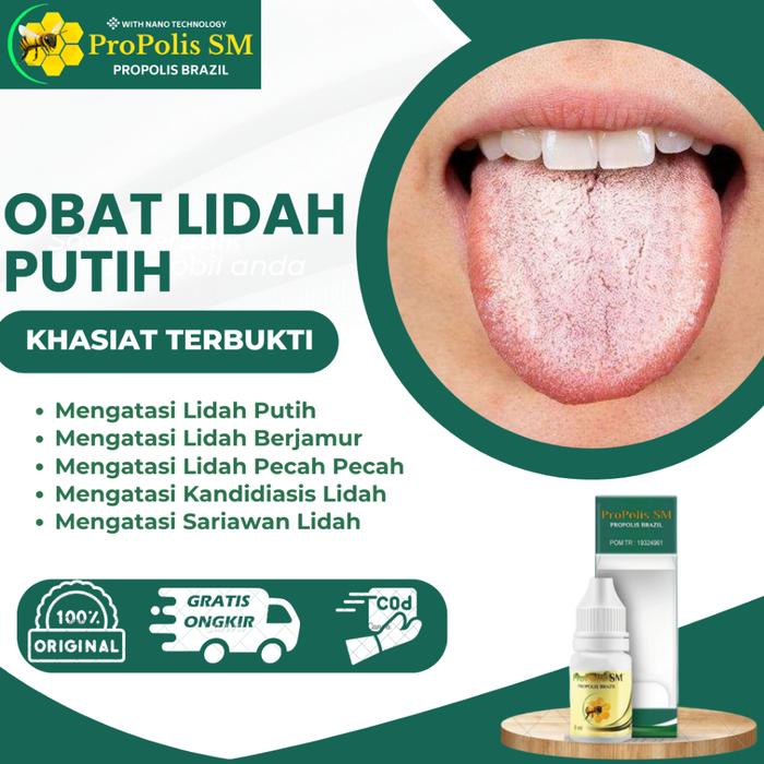 MAFAZA HERBS - OBAT LIDAH PUTIH, OBAT LIDAH BERJAMUR, OBAT LIDAH LUKA, OBAT LIDAH PECAH PECAH, OBAT