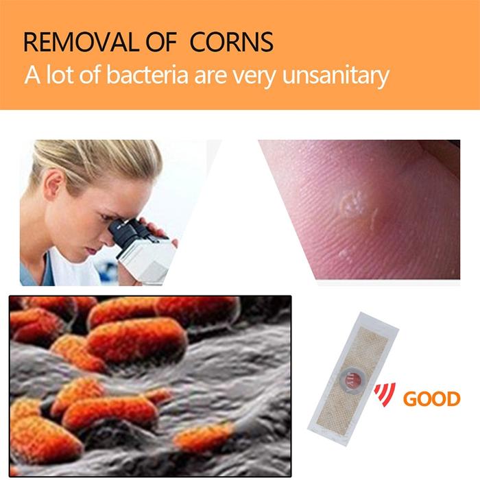 6PCS Plester Kutil Medis Penghilang Mata Ikan Kapalan Foot Corn Removal Sumifun