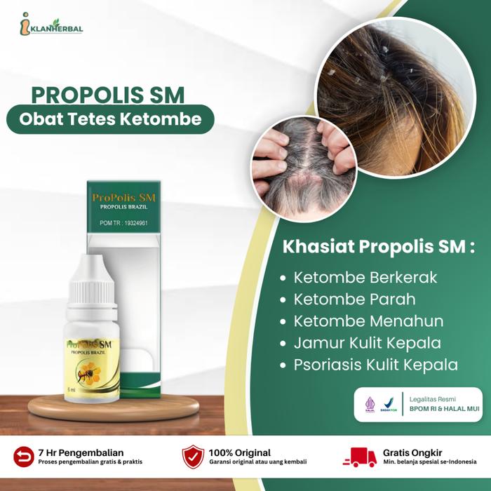 PROPOLIS SM - OBAT TETES KETOMBE BERKERAK, KETOMBE PARAH, KETOMBE BASAH, KETOMBE MENAHUN, JAMUR KULI