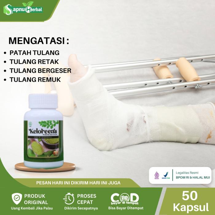 SAPNU HERBAL - OBAT PATAH TULANG, TULANG RETAK, TULANG BERGESER, PENYAMBUNG PATAH TULANG, FAKTUR TUL