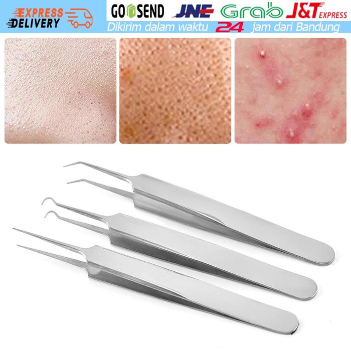 3Pcs/Set Pinset Jepit Komedo Stainless Steel / Alat Pencet Jerawat Dan kKomedo / Pinset Jerawat