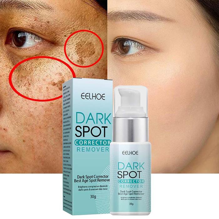 Niacinamide Whitening Freckle Creams Essential Oil Dark Spot Removal