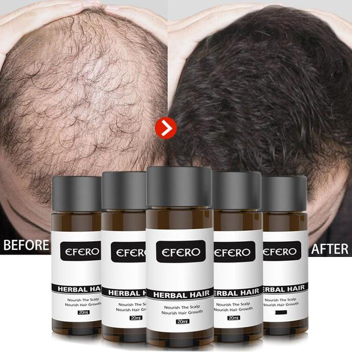 Ginger Hair Growth Essential Oil Serum Anti Hair Loss Products Fast