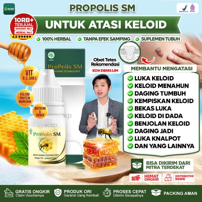 OBAT KELOID DAGING TUMBUH DAGING JADI PENGHILANG KELOID LUKA TINDIK DI TELINGA BEKAS OPERASI PROPOLI