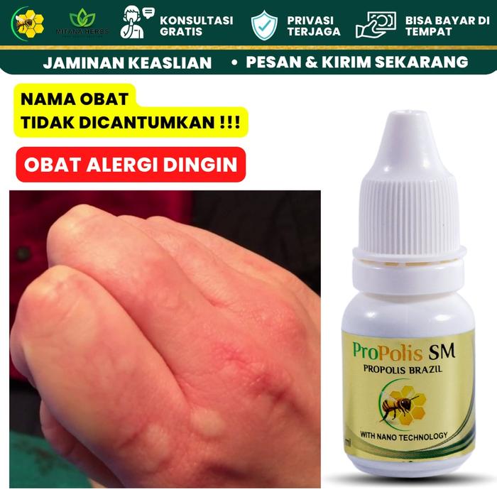 MITANA HERBAL / OBAT ALERGI DINGIN / OBAT ALERGI GATAL KULIT / OBAT GATAL ALERGI / OBAT BIDURAN ALER