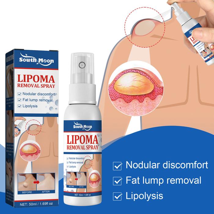 Lipoma Removal Spray Treat Skin Swelling Cellulite Ointment Tumor Exfoliating Pain Relief