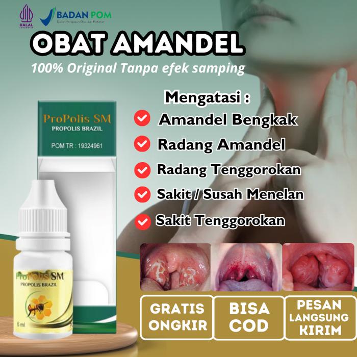 OBAT AMANDEL, OBAT RADANG TENGGOROKAN, OBAT AMANDEL BENGKAK, OBAT SAKIT TENGGOROKAN, OBAT SUSAH MENE