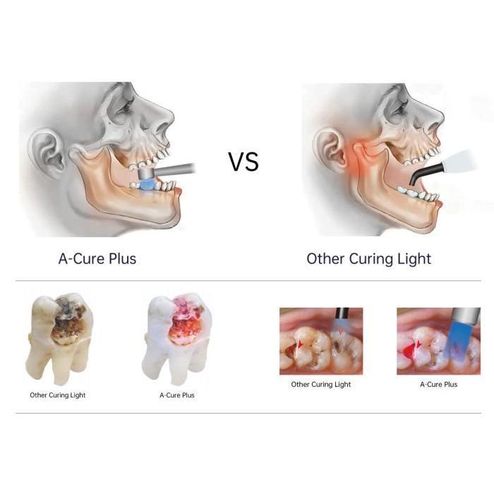Curing Light One Cure LED A-Cure Plus Dental Metal Head Refine