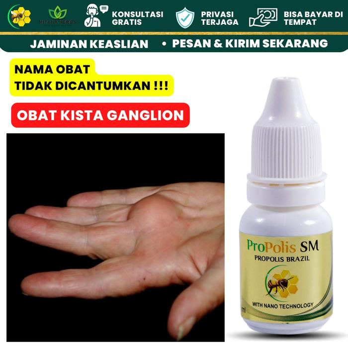 MITANA HERBAL / OBAT KISTA GANGLION / OBAT BENJOLAN LIPOMA / OBAT BENJOLAN DI TANGAN / OBAT PENGHILA