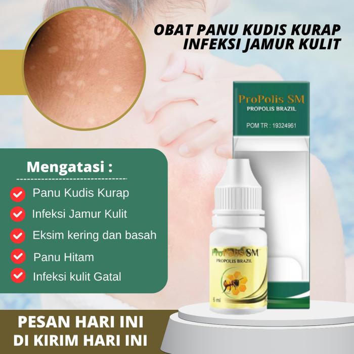 OBAT PANU, OBAT JAMUR KULIT, SALEP JAMUR KULIT, OBAT PANU ANAK DAN DEWASA, PENGHILANG PANU, OBAT PAN