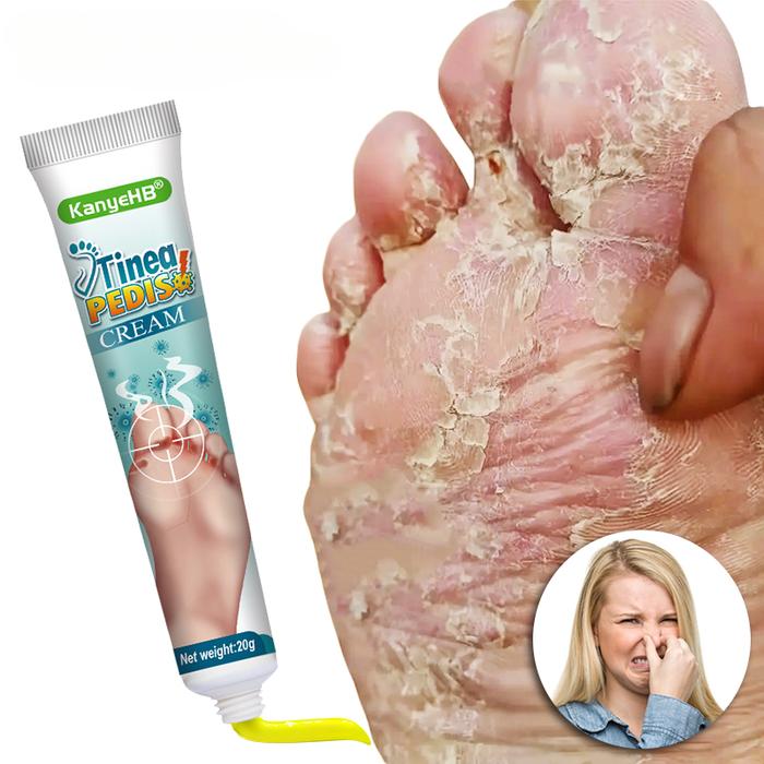 Foot Deodorant Cream Foot Odor Bacteriostasis Antipruritic Athlete's Foot Ointment Skin Topical Crea