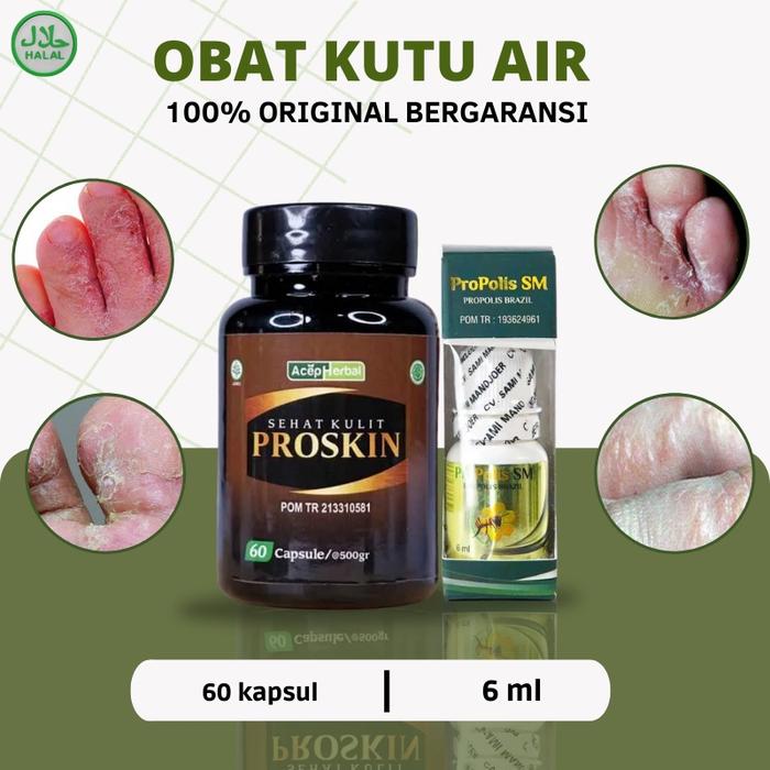 PROPOLIS SM - OBAT KUTU AIR, SALEP KUTU AIR DI TANGAN / DI KAKI, OBAT KUTU AIR UNTUK KAKI, OBAT GATA