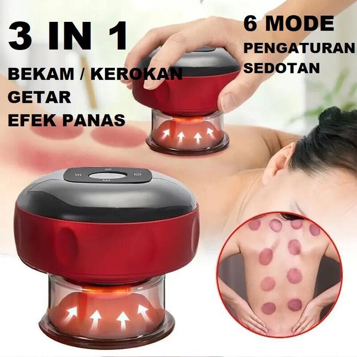Alat kerok elektrik Bekam elektrik Alat pijit kop elektrik