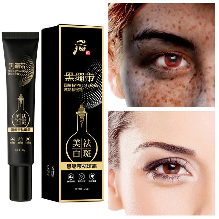Effective Whitening Freckle Cream Remove Melasma  Pigment