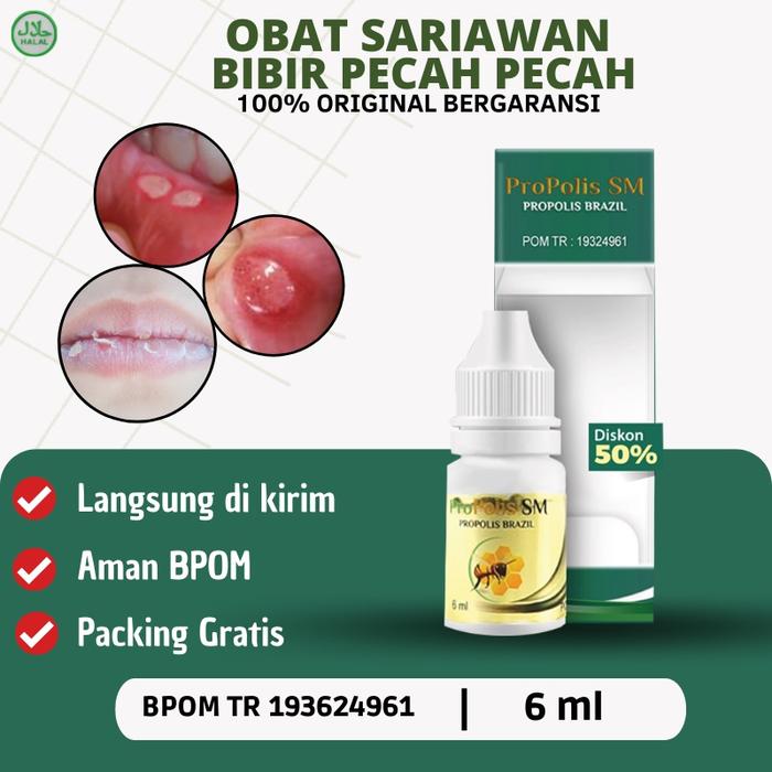 PROPOLIS SM - OBAT SARIAWAN, OBAT SARIAWAN LIDAH DEWASA, OBAT SARIAWAN MULUT, OBAT BIBIR PECAH PECAH