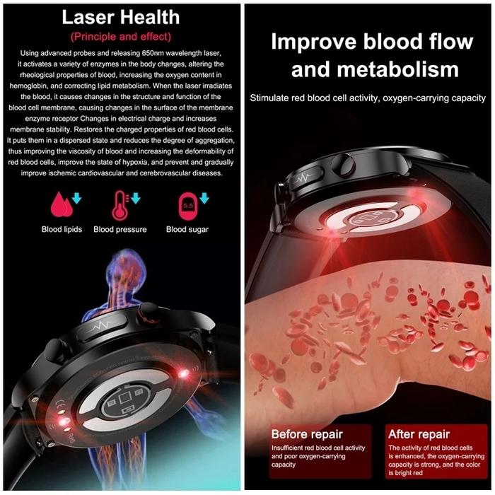 2023 New Smartwatch Blood Sugar Blood lipids Blood Pressure Body