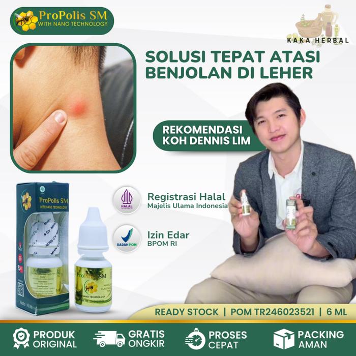 KAKA HERBAL - OBAT BENJOLAN DI LEHER, OBAT HERBAL BENJOLAN DI LEHER, MINYAK OLES BENJOLAN DI LEHER,