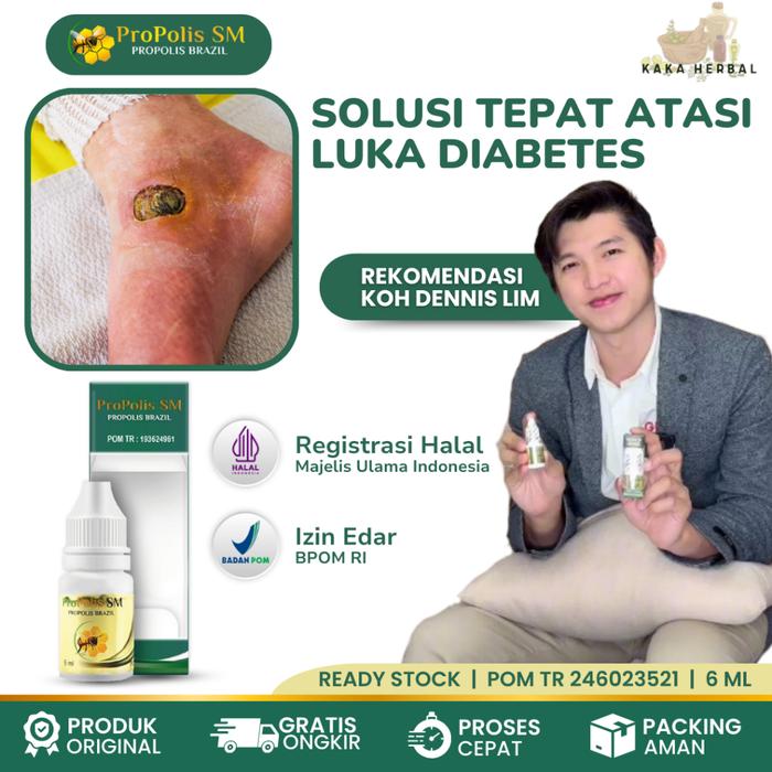 OBAT LUKA DIABETES AGAR CEPET KERING, OBAT LUKA DIABETES BERNANAH, OBAT DIABETES KENCING MANIS, OBAT