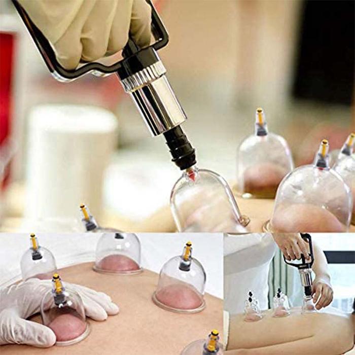 Pompa Bekam Washable Pompa Alat Bekam Alat Bekam Manual Pompa Bekam Kangzhu Kop Angin Bekam
