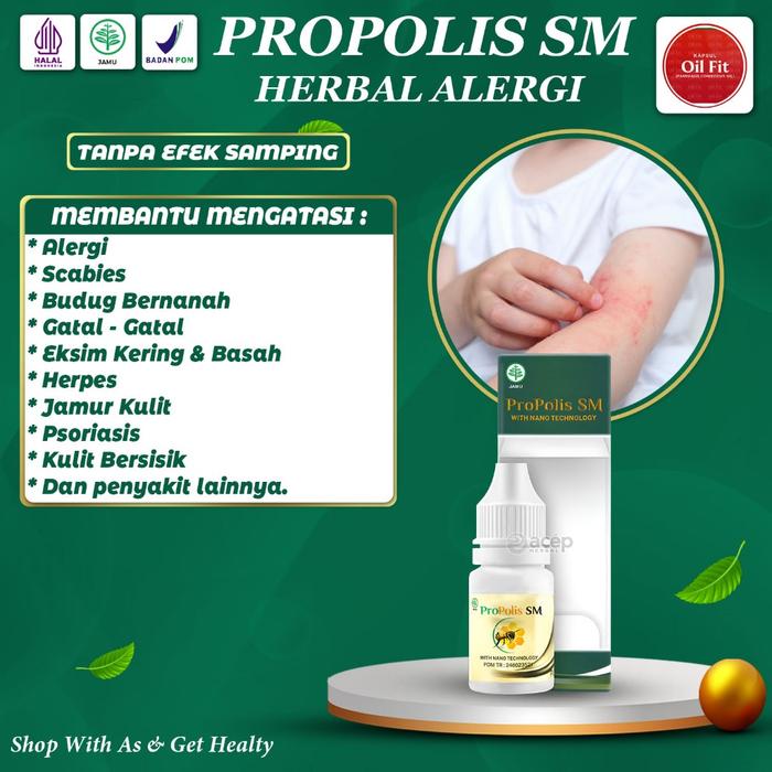 OBAT GATAL KULIT ALERGI DINGIN BIDURAN GATAL ALERGI HERBAL BENTOL KULIT, OBAT BIDURAN KRONIS, ALERGI