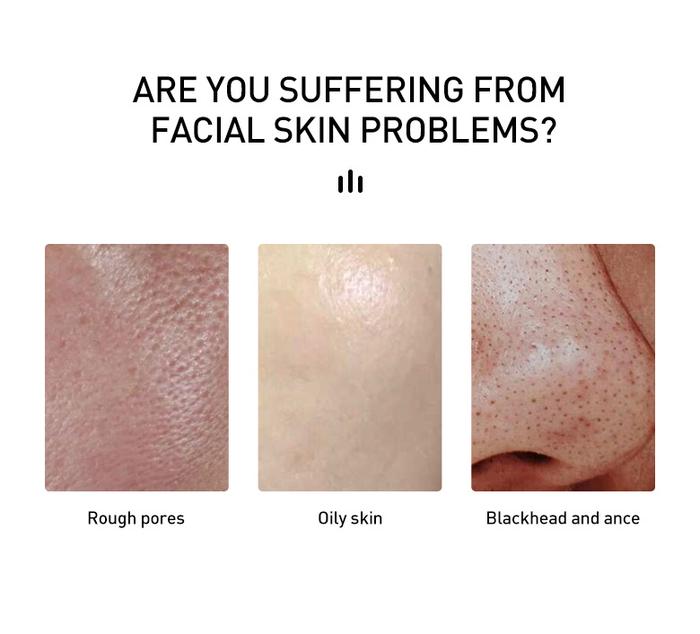 AUQUEST Salicylic Acid  Skin Care Hyaluronic Acid