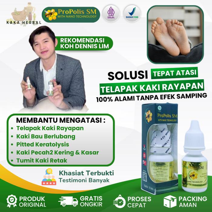 KAKA HERBAL - OBAT KAKI RAYAPAN TELAPAK KAKI, OBAT KAKI RAYAPAN DAN BAU, OBAT PITTED KERATOLYSIS, SA