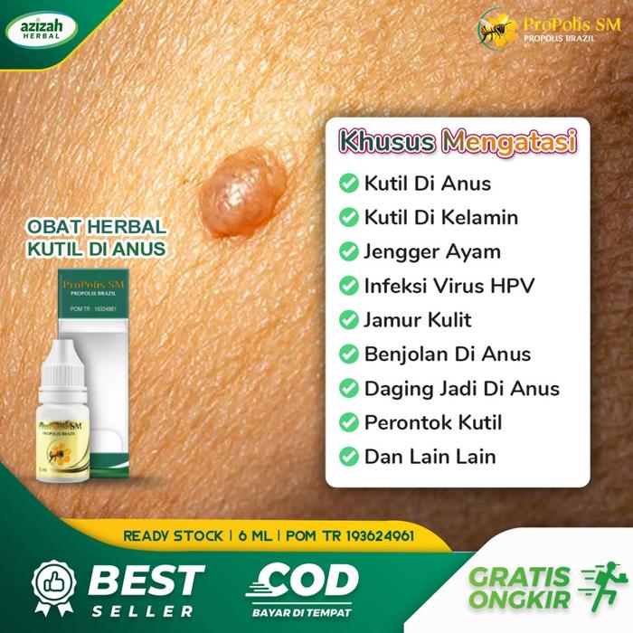 OBAT KUTIL DI ANUS PERONTOK KUTIL JENGGER AYAM DI DUBUR VIRUS HPV DAGING JADI SKIN TAGS BINTIK PUTIH