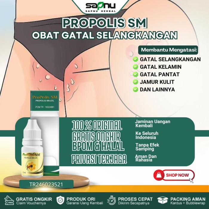 SALEP GATAL SELANGKANGAN, SALEP GATAL KULIT JAMUR, OBAT GATAL KULIT, SALEP GATAL JAMUR SELANGKANGAN,