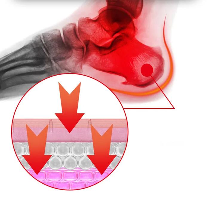 10Pcs/Set Koyo Sakit Tumit Kaki Koyo Kaki Pereda Nyeri Koyo Kaki Plantar Fasciitis Koyo Untuk Tumit