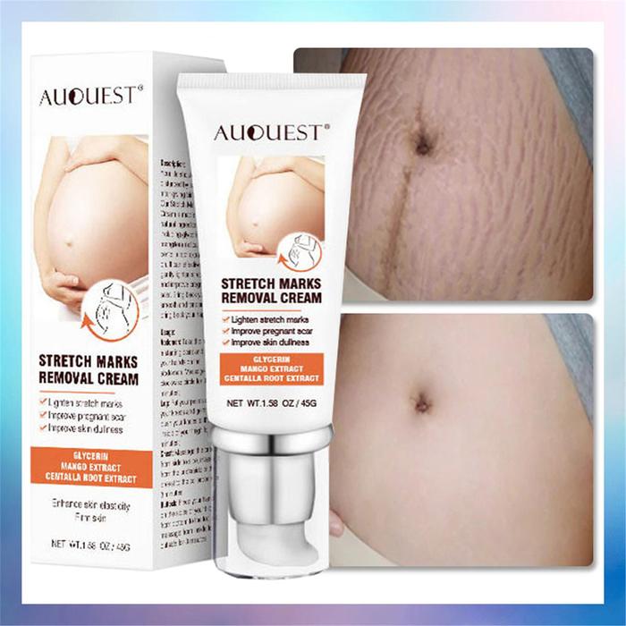 Stretch Marks Remover Cream Maternity Slackline Essential Oil Remove
